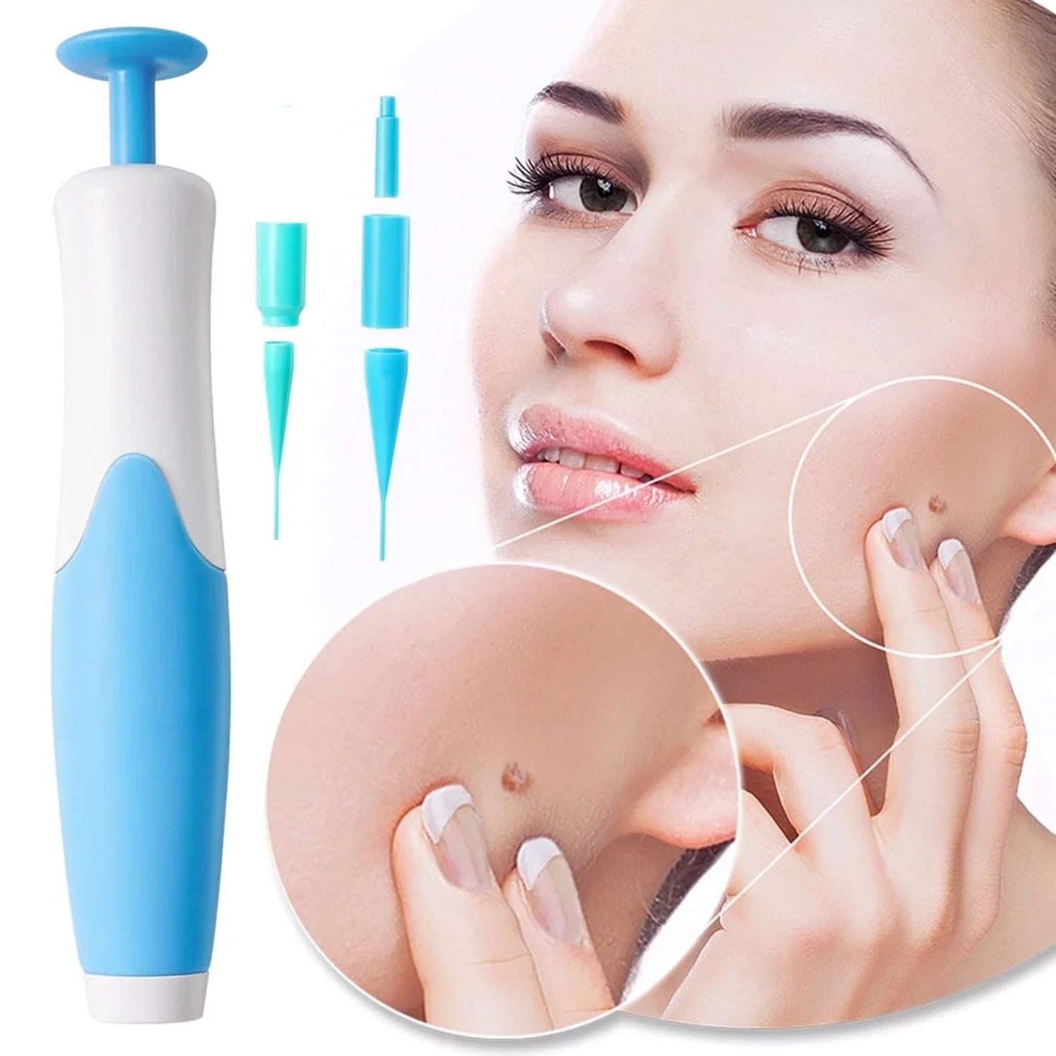 Skin Tag Remover Kit 2 in 1 for Micro to Large (2 mm - 8 mm / 1 Set)-Health & Personal Care-AniGuess-AniGuess