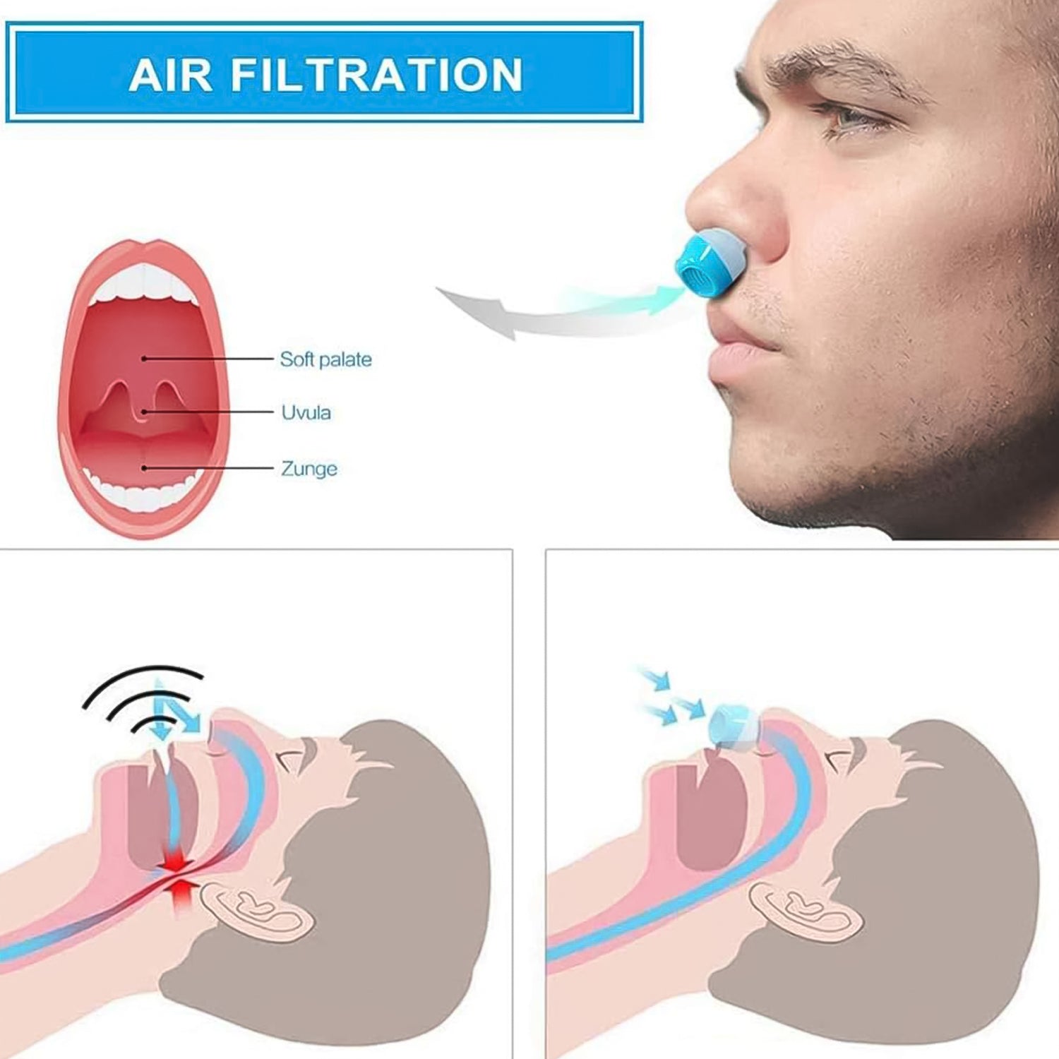 2 in 1 Anti-Snoring & Air Purifier Nose Clip Device (1 Pc / With Plastic Case)-Health & Personal Care-AniGuess-AniGuess